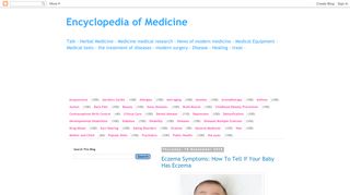 لقطة شاشة لموقع Encyclopedia of Medicine
بتاريخ 21/09/2019
بواسطة دليل مواقع سكوزمى