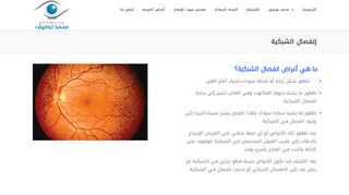 لقطة شاشة لموقع علاج انفصال الشبكية في مصر
بتاريخ 22/09/2019
بواسطة دليل مواقع سكوزمى